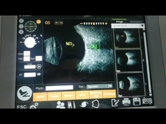 IOL υπολογισμού υψηλό έξοχο αξονικό ψήφισμα μηχανών 10MHz ανιχνευτών λειτουργίας υπερηχητικό