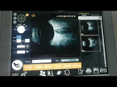 Β υπερηχητική ανιχνευτών εξέταση ασθενειών σώματος μηχανών ηλεκτρομαγνητική γυάλινη